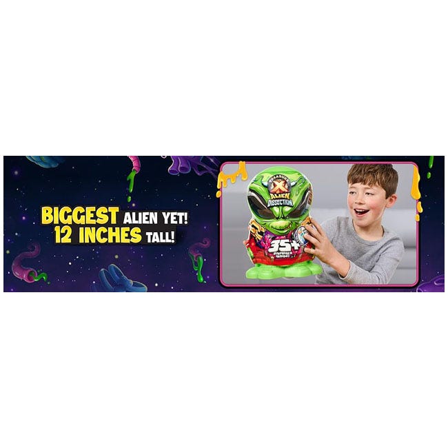 TREASURE X MEGA ALIEN DISSECTION SURPRISE